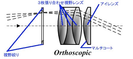 谷オルソ仕様